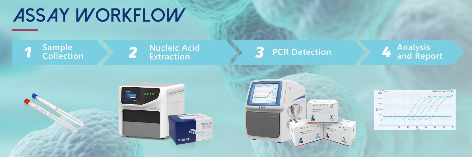 Kit PCR liên cầu khuẩn nhóm B Streptococcus - GBS 7 Quy trình xét nghiệm Kit PCR liên cầu khuẩn nhóm B Streptococcus - GBS